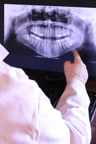 Best Emergency Dental Extractions in Tremont, PA