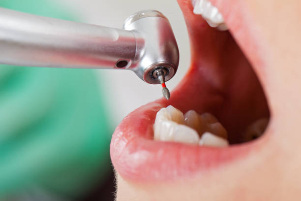 Best Broken or Cracked Tooth Emergency Dentist in Tremont, PA